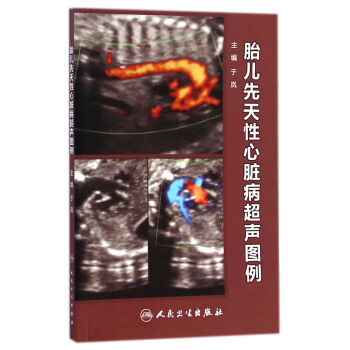 胎兒先天性心臟病超聲圖例