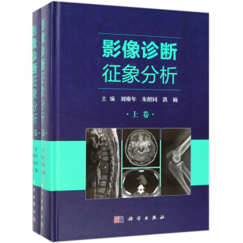影像診斷征象分析 影像診斷征象分析