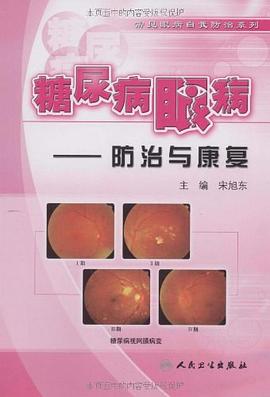糖尿病眼病 糖尿病眼病