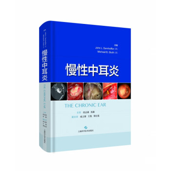 慢性中耳炎 慢性中耳炎