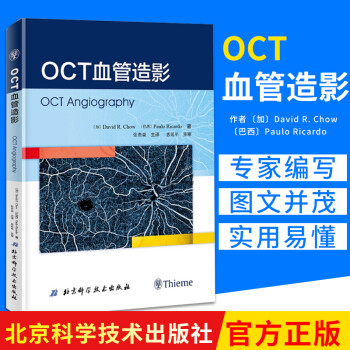 OCT血管造影 OCT血管造影