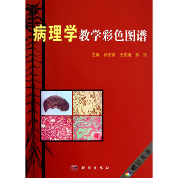 病理學(xué)教學(xué)彩色圖譜 病理學(xué)教學(xué)彩色圖譜