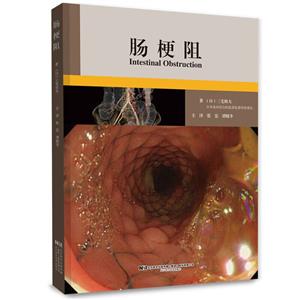腸梗阻 腸梗阻