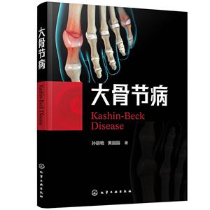 大骨節(jié)病 大骨節(jié)病