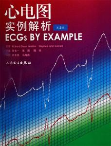 心電圖實例解析第2版 心電圖實例解析第2版