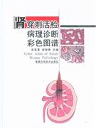 腎穿刺活檢病理診斷彩色圖譜 腎穿刺活檢病理診斷彩色圖譜