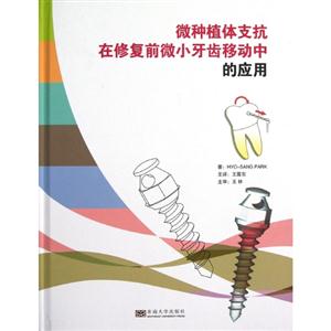 微種植體支抗在修復前微小牙齒移動中的應用 微種植體支抗在修復前微小牙齒移動中的應用