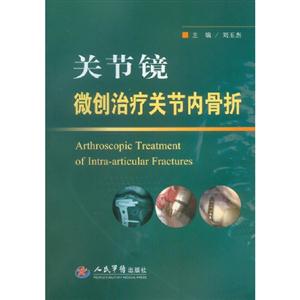 關節鏡微創治療關節內骨折 關節鏡微創治療關節內骨折